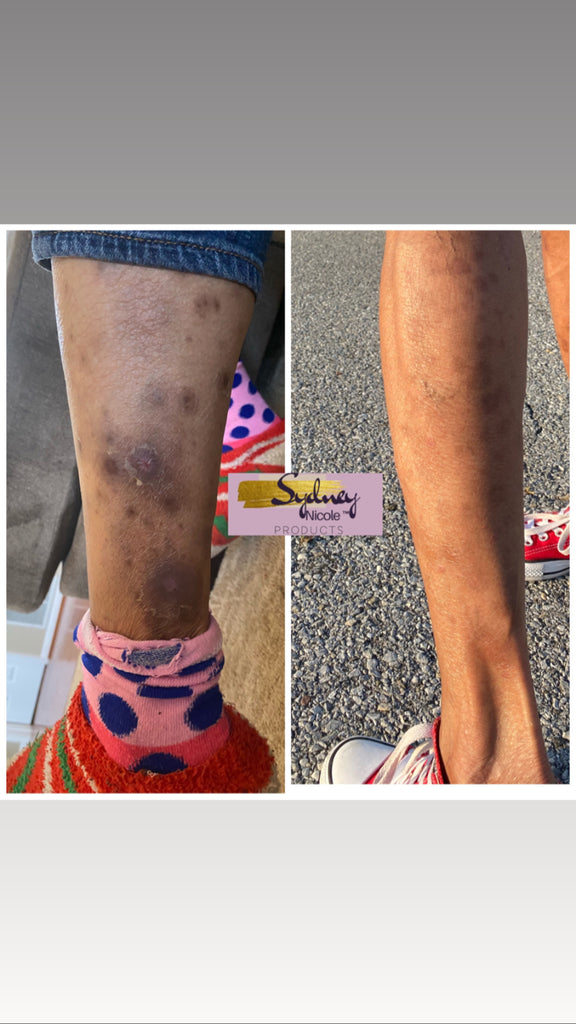 What’s Going On with Her Skin⁉️ Undiagnosed Skin Rash Cleared Up Using ...